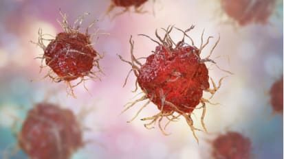 New Roswell Park Strategy for Overcoming Resistance to Immunotherapy Unleashes Power of Dendritic Cells