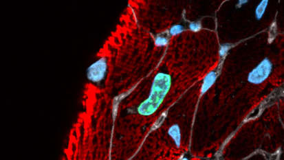 UTSW Researchers Discover Molecular Switch for Heart Regeneration