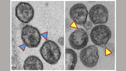 Preclinical Studies Led By Johns Hopkins Medicine Researchers Advance Potential New Target to Treat HIV Infection