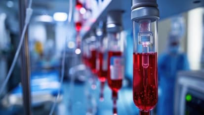 Tandem 2025: Roswell Park Team Creates Predictive Model to Inform Care of Lymphoma Patients