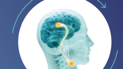 From Clinical Trial to Clinic: Neurostimulation Improves Outcomes in Post-Stroke Swallowing Recovery