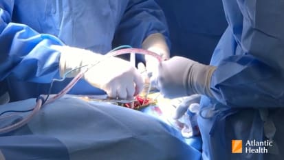 Inside Chiari Decompression: How Surgical Technique Shapes Outcomes 