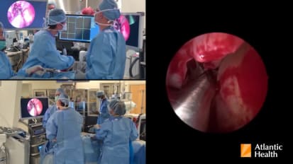 Endoscopic Pituitary Surgery: A Minimally Invasive Approach That Changes How These Tumors Are Treated 