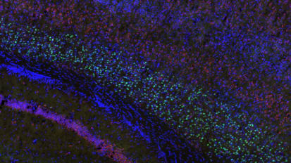 Unmasking autism spectrum disorder through its gene-based roots
