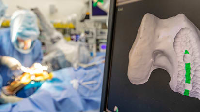 Robot-assisted Technology, 3D Printing and Better Outcomes