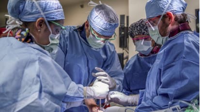 3D Printed Talus Replacement