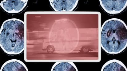 In-Ambulance Consults Cut Down on Critical Treatment Time for Stroke Patients