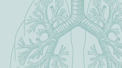 Sarcoidosis PH Case Study