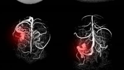 Reports from the Field: New Penn Trauma Research Offers Insights on ICU Design, Gun Violence and Equity