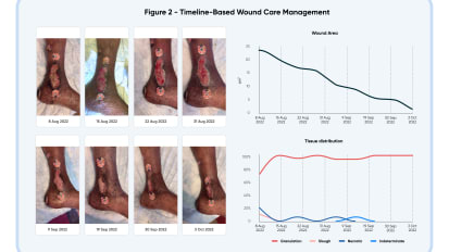 Improving Diabetic Foot Wound Care Through Technology