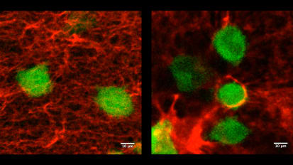 A Promising Strategy for Preventing Cancer Metastasis and Enhancing Dormancy