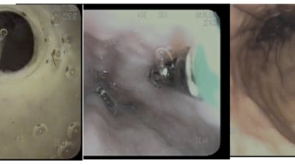 A Full Spectrum of Care for Patients with Swallowing Disorders 