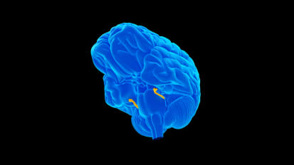 Taking a Deeper Look at Trigeminal Neuralgia