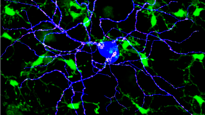 Drug Targeting Tauopathies in Mice Reveals Sex Differences in Response