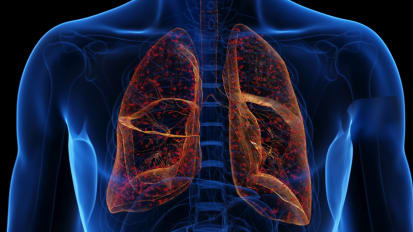 UCSF Among First in U.S. to Receive New Pulmonary Care Designation