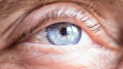 Novel surgical technique may be more effective in treating common eyelid disorder