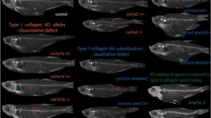 Orthopaedics and Sports Medicine Researchers Find Valuable Similarities Between Connective Tissue Disorders in Mutant Zebrafish and Humans