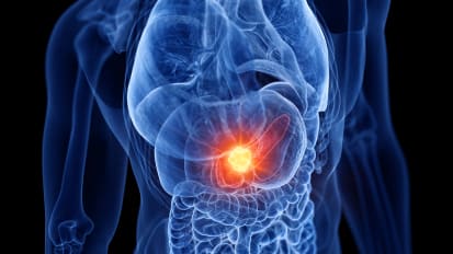 The Future of Radiation Oncology and Pancreatic Cancer