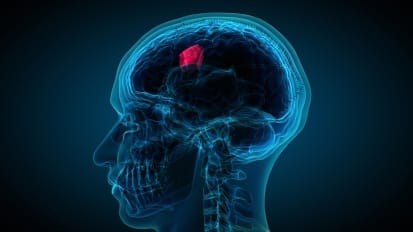 Evolving Advances in Brain Tumor Care: Insights from Medical and Radiation Oncology