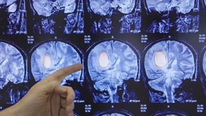 Novel Treatments for Glioblastoma Multiforme