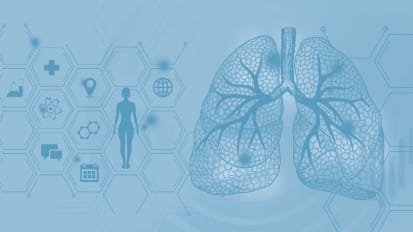 2023 State-of-the-Art Treatment for Early Stage Lung Cancer