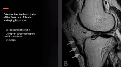 Injuries to the Extensor Mechanism of the Knee in the Athletic and Aging Population