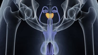 Testis Cancers: Screening, Treating & Surviving