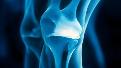 Evaluation and Management of Meniscus Tears