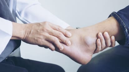 Approach to Ankle Sprains