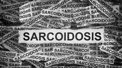 Sarcoidosis - TEST FOR PODCAST