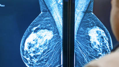 Breast Cancer Indications for Mastectomy and Reconstruction Options