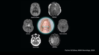 From Coma to Clarity: The Art and Science of Neuroprognostication