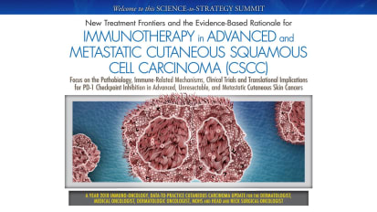 Immunotherapy in Advanced and Metastatic Cutaneous Squamous Cell Carcinoma (CSCC) [9692]