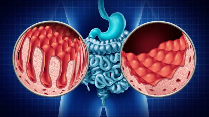 Demystifying Celiac Disease in Kids: Diagnostic and Treatment Strategies