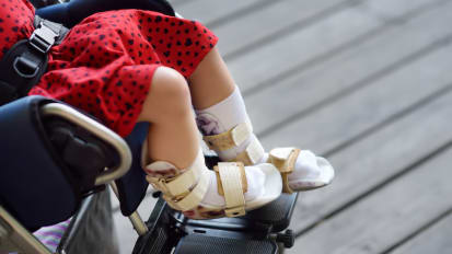 From Knees to Toes: Straight Talk on Common Orthopedic Abnormalities in Kids