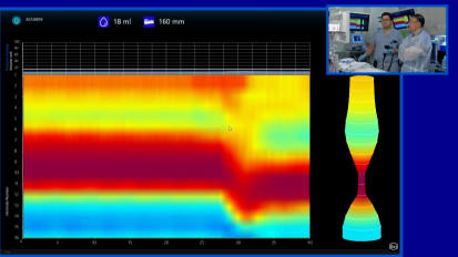 2019 LI Live: Live Endoscopic Procedures - Morning Part 1 of 2