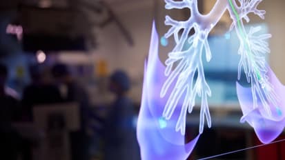 Leading the Way in Lung Cancer Treatment: Multidisciplinary and Radiomic Approaches for Lung Cancer