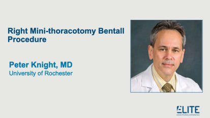 右小型托拉科切除本形程序