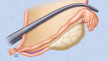 Beyond reflexive and prophylactic gynecologic surgery