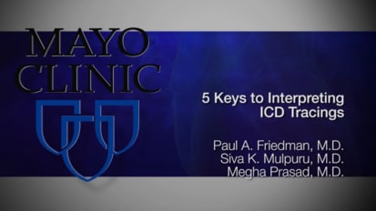 Tips for interpreting implantable cardioverter-defibrillator ICD tracings