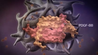 AUGMENT® Physician Testimonial Video - MOA [MKS437]