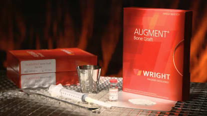 AUGMENT® Physician Testimonial Video - Adequate Graft Fill [MKS442]