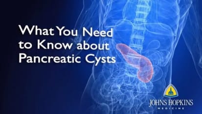 What You Need to Know About Pancreatic Cysts