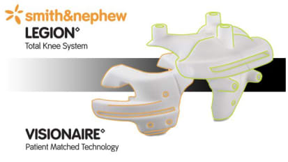 LEGION™ Total Knee System with VISIONAIRE™ Patient Matched Instrumentation