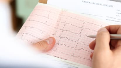 Clinical Minutes: Updates on Cholesterol Therapy