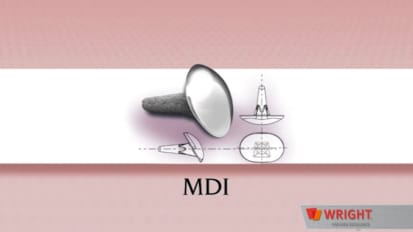 MDI™ Surgical Technique [010687]