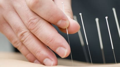 Grand Rounds: Evidence-Based Acupuncture For People With Cancer