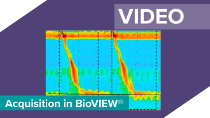 Acquisition of Esophageal Manometry Study using an HRiM Small Diameter Probe