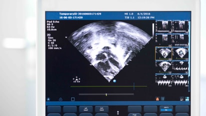The Basics of C-MRI in Cardio-Oncology