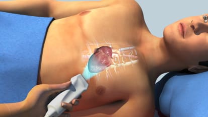 Grand Courts:Aortic Regurtiation:Echo评估现代管理指南